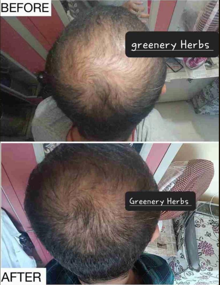 Adivasi Hakki Pikki Neelambari Herbal Hair Oil