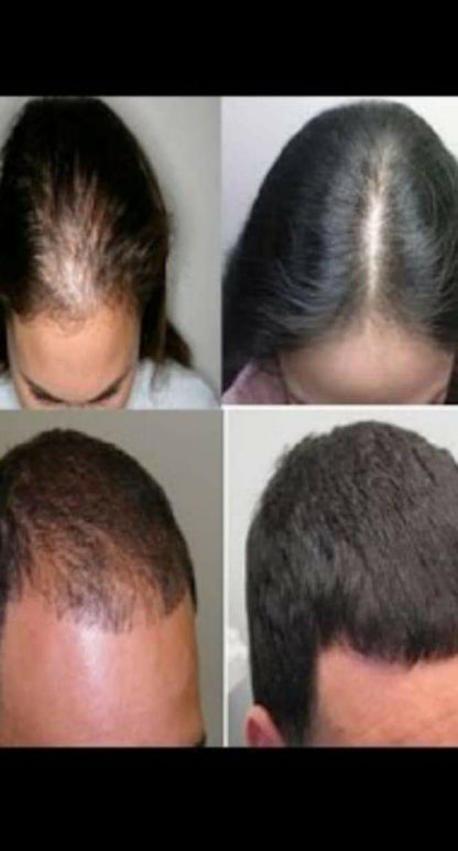 Adivasi Hakki Pikki Neelambari Herbal Hair Oil