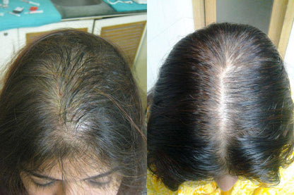 Adivasi Hakki Pikki Neelambari Herbal Hair Oil