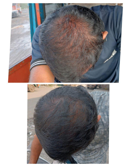 Adivasi Hakki Pikki Neelambari Herbal Hair Oil